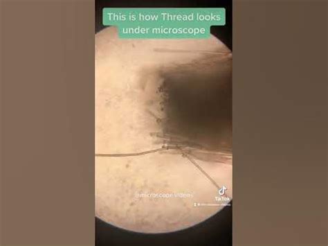 Image result for Threadbare Spots