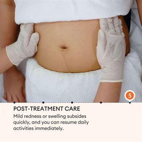 Laser Lipolysis Body Treatment | Fat Removal without Surgery