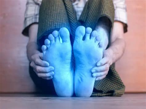 Kidney health alert: 6 early signs of kidney disease in legs and hands ...