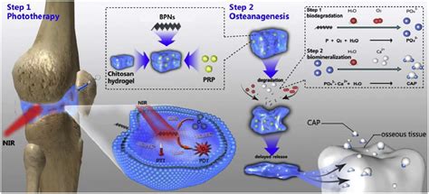Advances in Intra-Articular Injection Hydrogel Drug Delivery Systems in ...