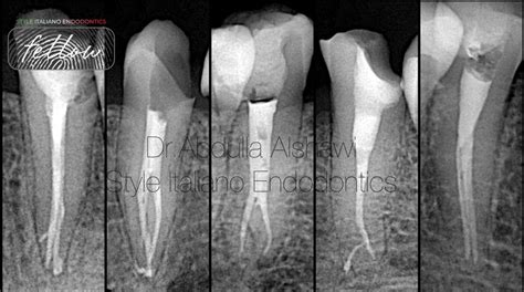 Endodontics Limited Oxford Valley at John Triche blog