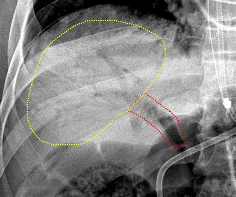 Case #7 | CaseStacks.com
