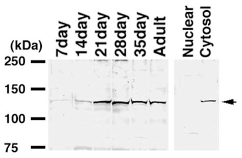 Analysis of Ser/Thr Kinase HASPIN-Interacting Proteins in the Spermatids