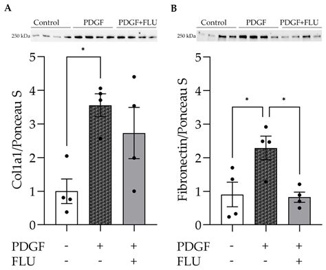 Sigma-1 Receptor Agonist Fluvoxamine Ameliorates Fibrotic Response of ...