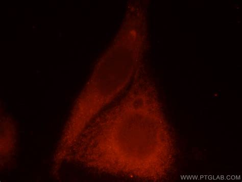 CaMKII Gamma antibody (12666-2-AP) | Proteintech