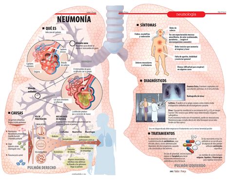 Del resfriado a la neumonía - Salud Ediciones