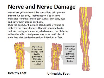 Image result for horsetail and nerve damage