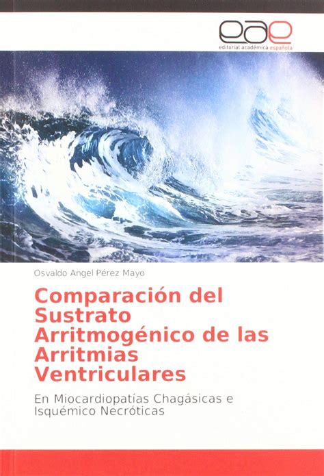 Buy Comparación del Sustrato Arritmogénico de las Arritmias ...