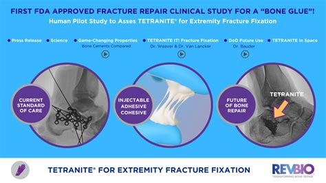 RevBio Receives FDA Approval for First Clinical Trial of TETRANITE Bone ...