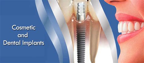 Dentist Clinic in Grant Road & Mumbai - Family Dental Care in Kemps ...