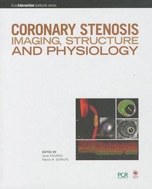 Buy Coronary stenosis imaging édition structure and physiology By ...