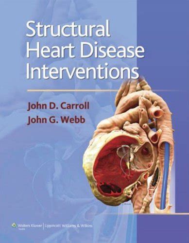 Structural Heart Disease Interventions eBook : Carroll, John D., Webb ...