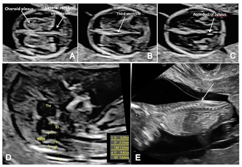 Fetal Echo Certification - prntbl.concejomunicipaldechinu.gov.co