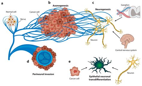 Tumor Microenvironment Modulation by Cancer-Derived Extracellular Vesicles