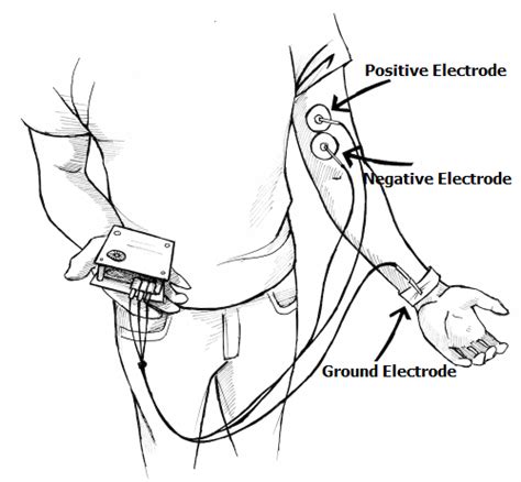 Image result for Muscle Activity EMG