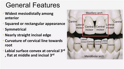 Morphology of Permanent Maxillary Central Incisor- Dr. Saba Arshad.pptx