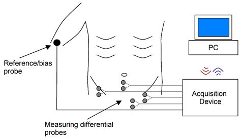 Processing of EMG Signals with High Impact of Power Line and Cardiac ...