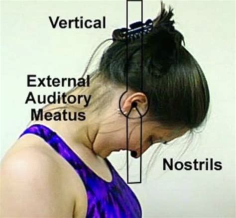 Image result for Cervical Rotation Goniometry