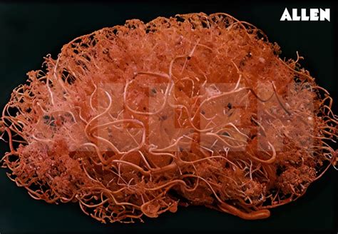 Choroid: Anatomy, Function, Choroid Plexus