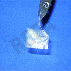 Amnio Cornea Graft Delhi, Amnio Cornea Graft India | India