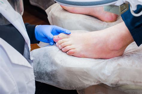 Ingrown Toenail Baton Rouge | Baton Rouge Ingrown Toenail Doctor