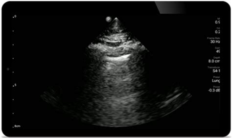 Anesthesiology | Philips Healthcare