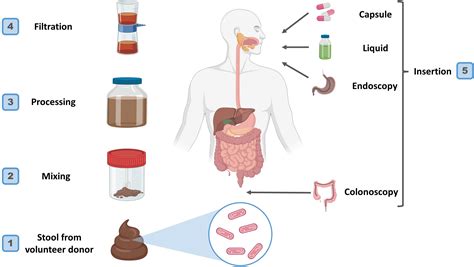 Frontiers | Safety and efficacy of fecal microbiota transplantation ...
