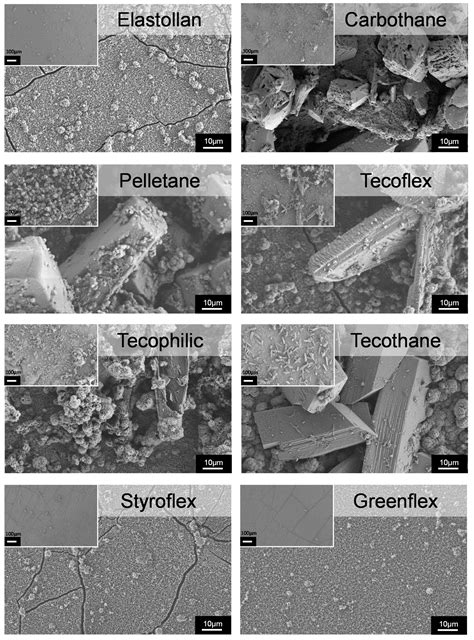 Prevention of Encrustation on Ureteral Stents: Which Surface Parameters ...