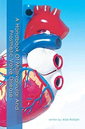 A Handbook of Multivalvular and Prosthetic Valve Disease eBook : Ranjan ...