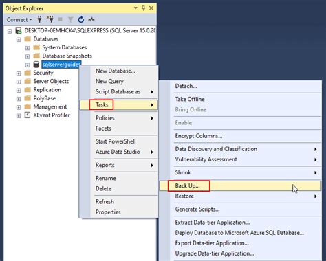 Backup Types in SQL Server 的图像结果