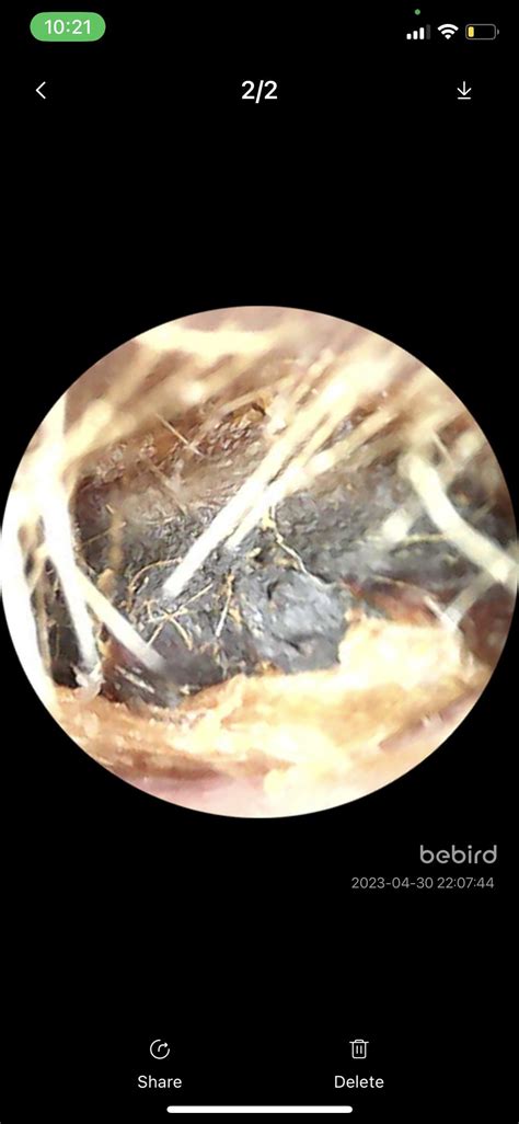 Just cleaned my ears for the first time in 2 years. I can hear colors ...