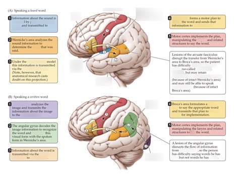 Image result for Conduction Aphasia