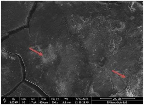 Evaluation of Alterations That May Occur on Root Surfaces after Root ...