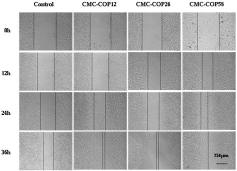Sponges of Carboxymethyl Chitosan Grafted with Collagen Peptides for ...
