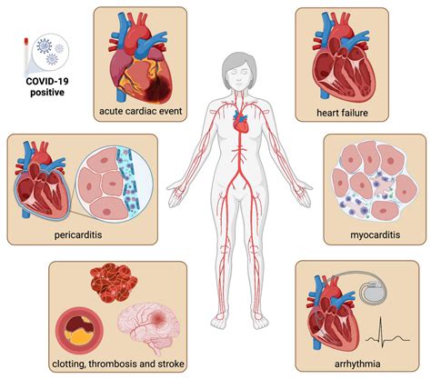 Cardiovascular Tropism and Sequelae of SARS-CoV-2 Infection