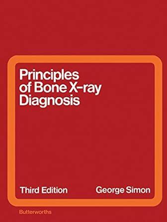 Principles of Bone X-Ray Diagnosis eBook : Simon, George: Amazon.in ...