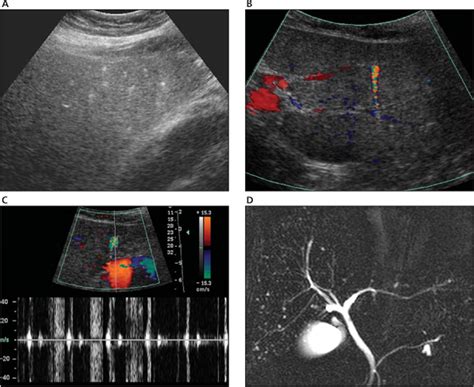 Image result for Ultrasound Lab