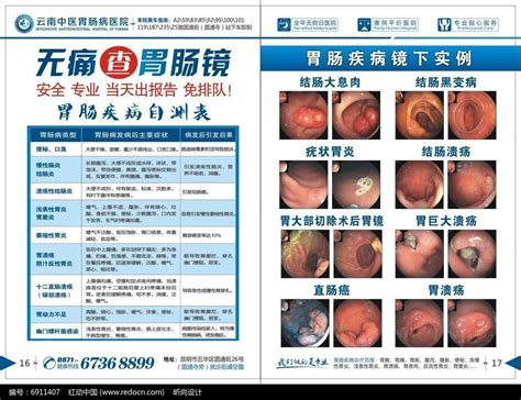 胃肠镜实例图杂志设计图片下载_红动中国