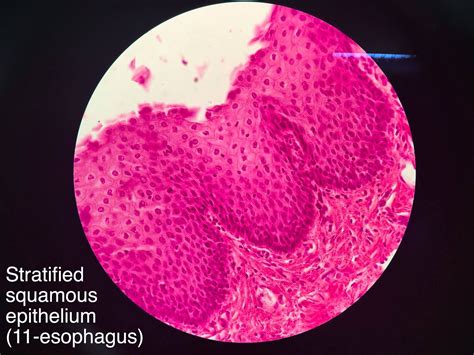 Non Keratinized Stratified Squamous Epithelium - JessieewaHenson