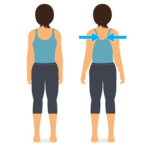 Common Recovery Exercises after Shoulder Replacement Surgery