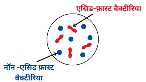 झेड-एन स्टेनिंग क्या है ZN Staining in Hindi - RBR Life Science
