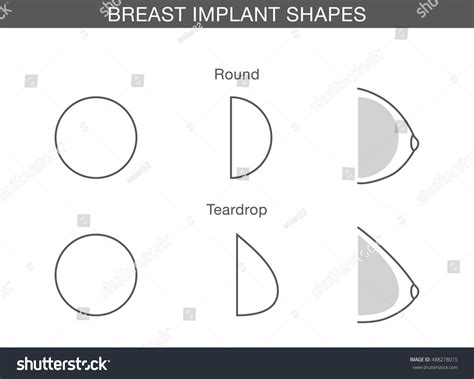 Difference Breast Implant Round Teardrop Shapes Stock Vector (Royalty ...
