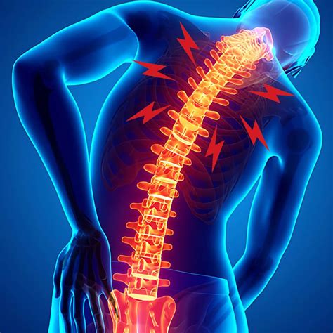 Upper Back Pain | Root Causes and Relief Exercises