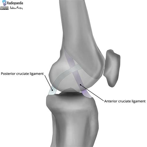 Radiopaedia - Drawing Anterior and posterior cruciate ligaments of knee - English labels ...