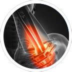 Dry Needling Therapy Near Me - View Cost, Book Appointment Online | APRC