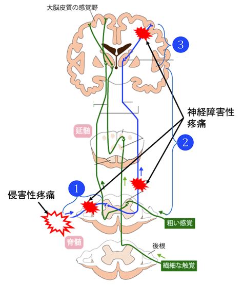 Image result for Alien Facehugger Medical Mask
