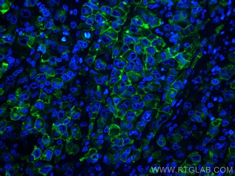 CD30/TNFRSF8 antibody (55132-1-AP) | Proteintech