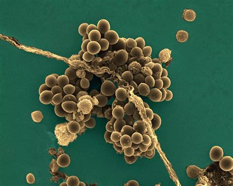 Staphylococcus aureus: A new mechanism involved in virulence and antibiotic