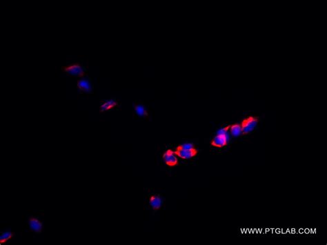 RRBP1 antibody (82890-1-PBS) | Proteintech