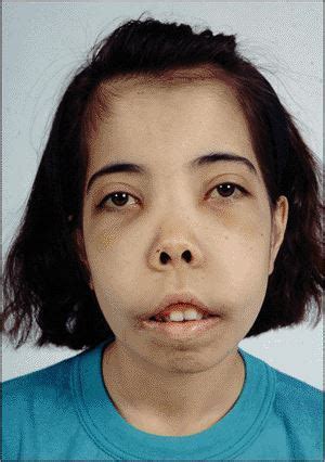 ::Dr. Shilpa Bhartia :: General Haematology, Thalassemia, Alpha ...